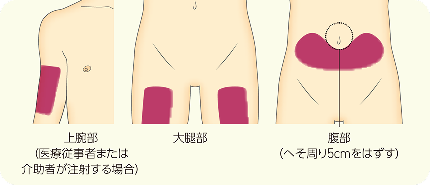 イラスト 注射する部位を確認します